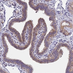 Lgi4 Antibody, Novus Biologicals:Antibodies:Primary Antibodies
